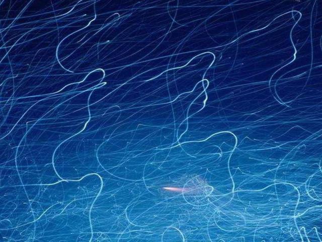 Brain Veins